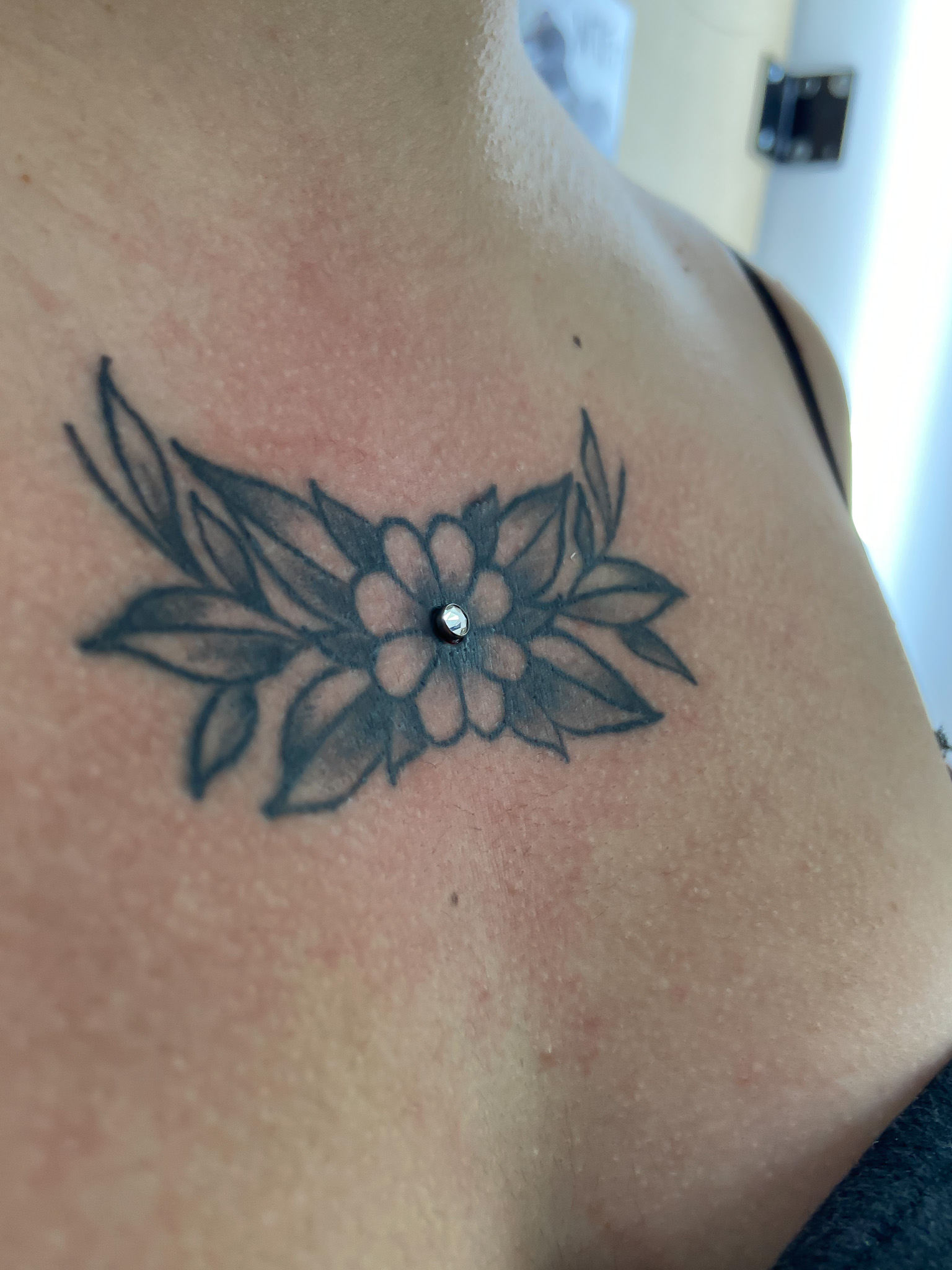 Microdermals
